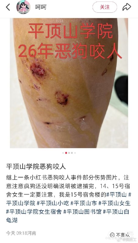 杯面骑士: jandan.net/t/6130462OO: 150 XX: 17TQL: 前人挖坑，后人遭殃OO: 100, XX: 0TBC: 可惜不是同一个人OO: 73, XX: 0蛋友16fe92566c896: 无孩爱猫女OO: 26, XX: 0傻风牌烧仙草: 狗咬人关我哈基米什么事OO: 16, XX: 0杯面骑士: jandan.net/t/6130462OO: 150 XX: 17TQL: 前人挖坑，后人遭殃OO: 100, XX: 0TBC: 可惜不是同一个人OO: 73, XX: 0蛋友16fe92566c896: 无孩爱猫女OO: 26, XX: 0傻风牌烧仙草: 狗咬人关我哈基米什么事OO: 16, XX: 0