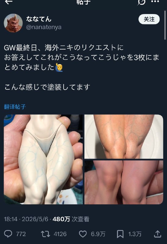 嗷嗷嗷: jandan.net/t/6140617OO: 122 XX: 25蛋友170609159e8d2: 你就说这腿邦邦不邦邦OO: 38, XX: 0kimivain: 大隐静脉5大属支：旋髂浅静脉、腹壁浅静脉、会阴外侧静脉、股内侧、股外侧浅静脉OO: 18, XX: 0嗷嗷嗷: jandan.net/t/6140617OO: 122 XX: 25蛋友170609159e8d2: 你就说这腿邦邦不邦邦OO: 38, XX: 0kimivain: 大隐静脉5大属支：旋髂浅静脉、腹壁浅静脉、会阴外侧静脉、股内侧、股外侧浅静脉OO: 18, XX: 0